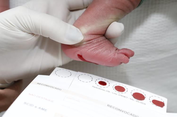 Teste do pezinho: DF é capaz de diagnosticar 62 doenças através do exame gratuito