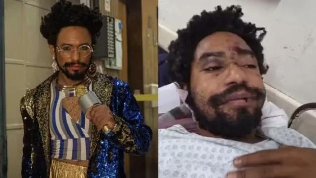 Polícia de SP investiga grave ataque homofóbico ao ator Diego Summer