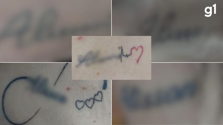 Dentista é preso suspeito de manter companheira em cárcere privado e forçá-la a fazer 10 tatuagens com o seu nome