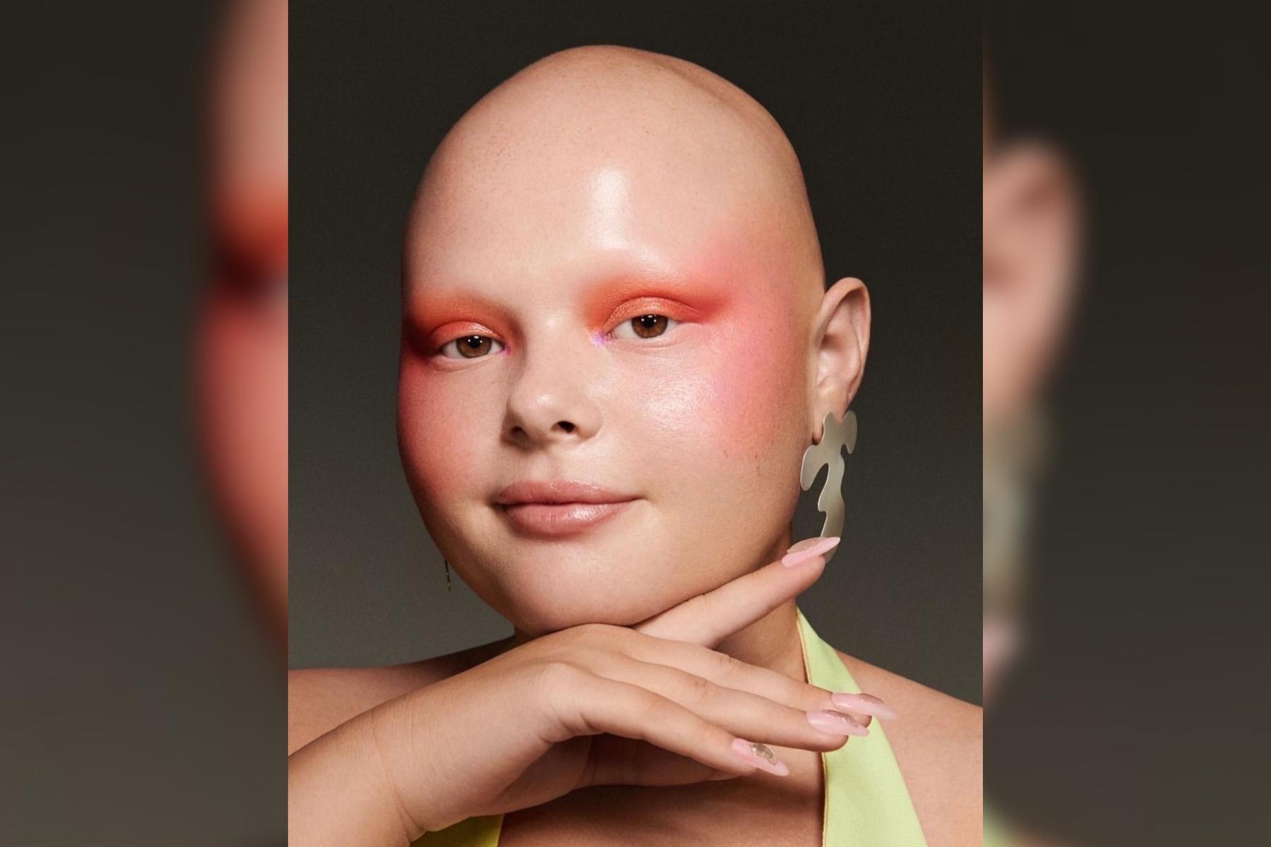 Madison Woytovich turns a childhood challenge into confidence and purpose