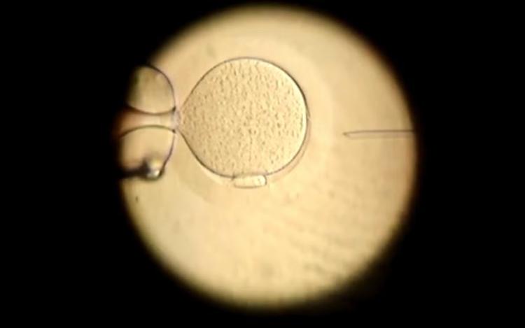 Pacientes pagam por complementos da fertilização in vitro sem evidência robusta de eficácia, diz estudo