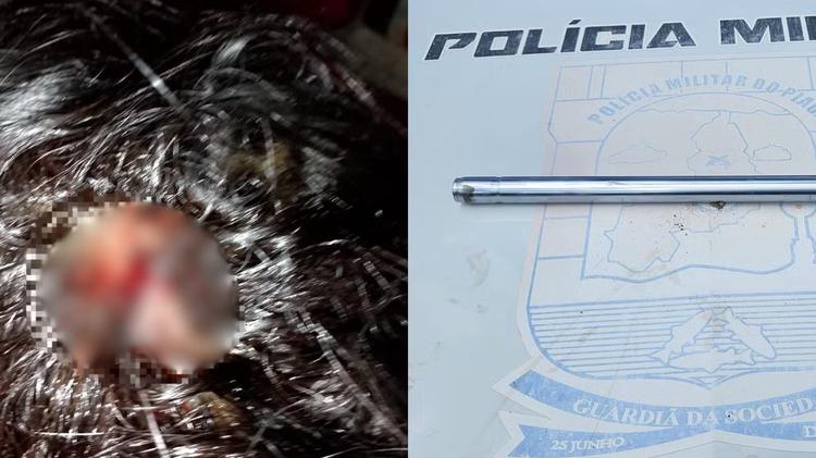Homem é preso por agredir mulher com barra de ferro na cabeça em cidade no PI; 3º caso em 36h
