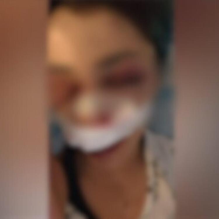 Identificati i primi due aggressori della studentessa picchiata a Bari
