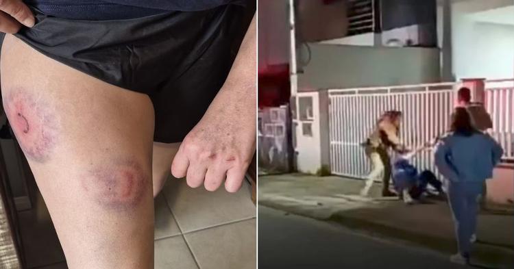 Candidata a suplente ao Senado é agredida durante abordagem da PM em Jaraguá do Sul