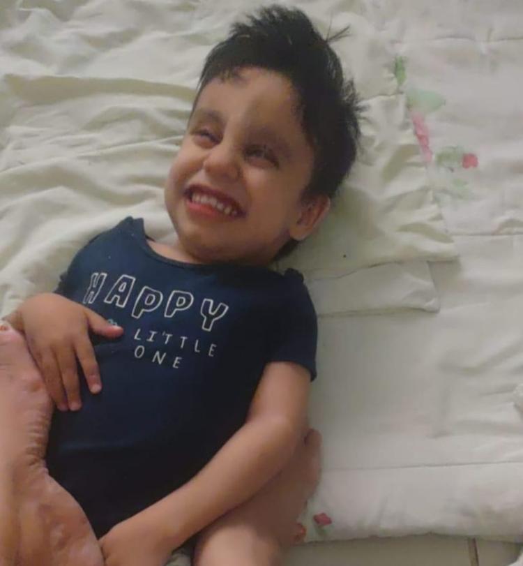 Foto colorida de João Lucas, criança com síndrome de lowe. Ele é branco e tem cabelo preto, está usando uma camiseta azul e deitado