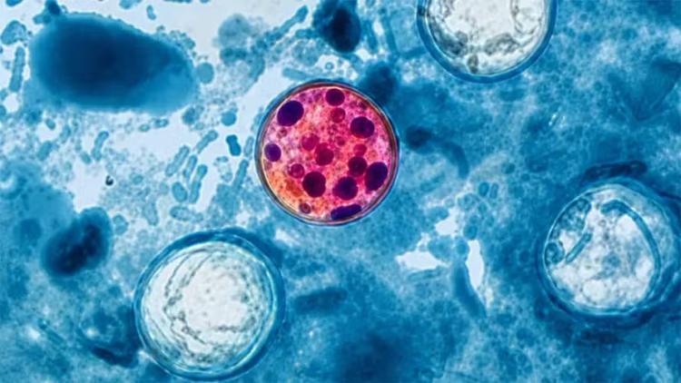 Alerta: Mass. tem mais de 100 pessoas infectadas com o parasita Cyclospora
