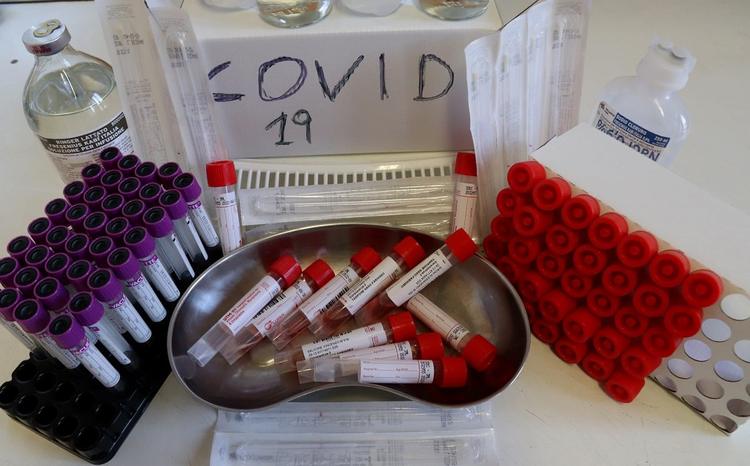 Kit Covid pagati il triplo, condannati 3 dirigenti Estar