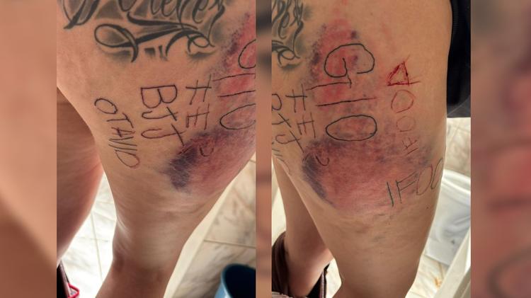 Irmão de jovem tatuada à força pelo ex diz que a encontrou sentada em calçada após fuga: 'Está caindo na realidade só agora'