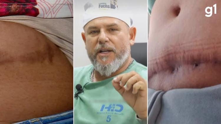 'Me sinto como se fosse um lixo', diz paciente de cirurgião plástico réu acusado de quatro tipos de crime ao operar mulheres