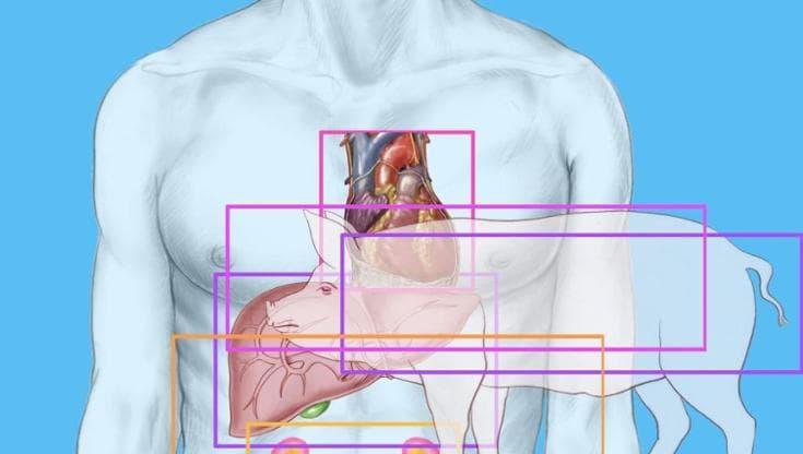 Fegato di maiale trapiantato in un uomo: è un successo il "ponte" per un organo umano