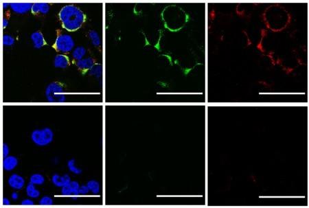 'Eliminar no grito': cientistas usam ultrassom para 'estourar' vírus da gripe e podem inaugurar novo tipo de tratamento