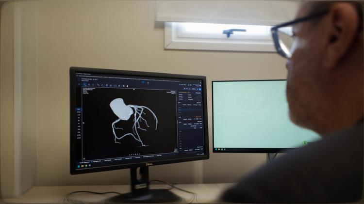 Unimed Serra Gaúcha implementa IA no apoio a laudos de tomografia