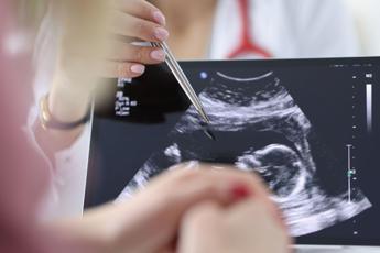 Chirurgia, si rompe l'aorta e viene operata con il bimbo in utero, intervento record a Milano