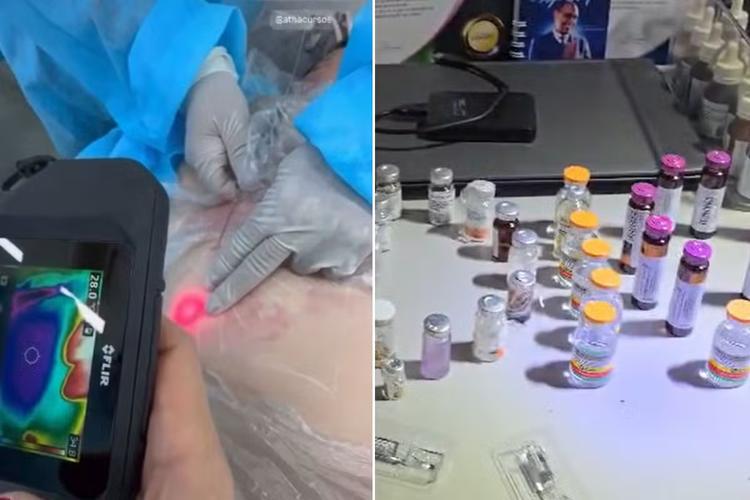 Mulher é presa por realizar procedimentos estéticos em clínica clandestina no litoral de SP; VÍDEO