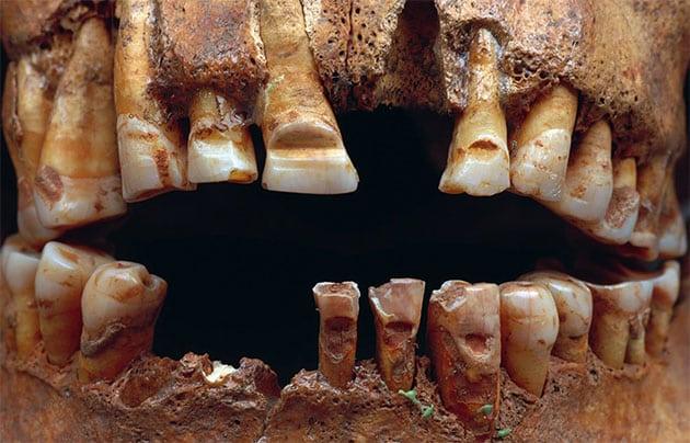 Detailansicht eines Schädels mit Zahnrillen.Quelle/Copyright: SHM/Lisa Hartzell 2007-06-13  / CC BY 2.5 DEED