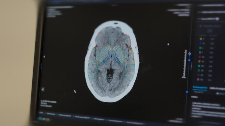 UNIMED SERRA GAÚCHA IMPLEMENTA IA NO APOIO A LAUDOS DE TOMOGRAFIA