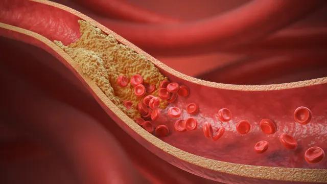 10 alimentos que cardiologistas indicam para baixar o colesterol