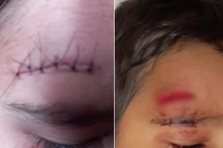 Menino de 6 anos leva pontos na testa após se machucar em banheiro de escola no interior de SP