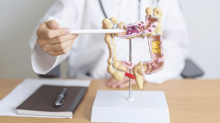 Carcassonne : une journée de sensibilisation au dépistage du cancer colorectal
