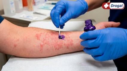 Para que serve a violeta genciana? Conheça todas as funcionalidades