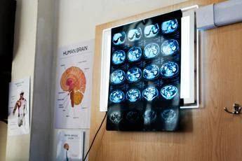 Chirurgia, operare il cervello a paziente sveglio: a Catania congresso Sinch