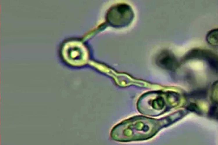 Acidophile Pilze? Studie diskutiert ungewöhnliche Kandidaten für Leben auf der Venus