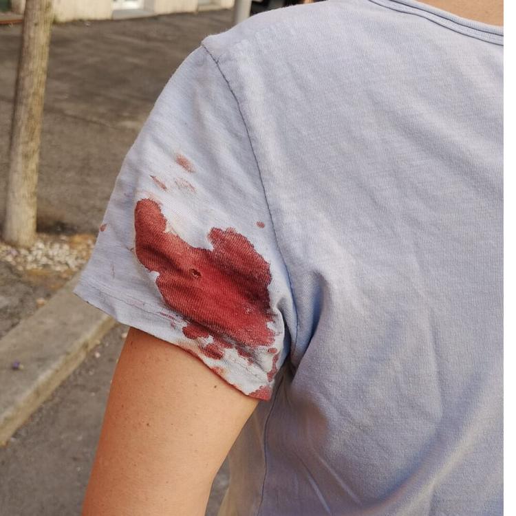 Donna ferita da un proiettile, paura in centro a Roma