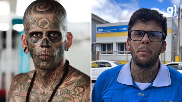 'Mais tatuado do Brasil' detalha tratamento contra câncer após 1ª sessão de quimioterapia