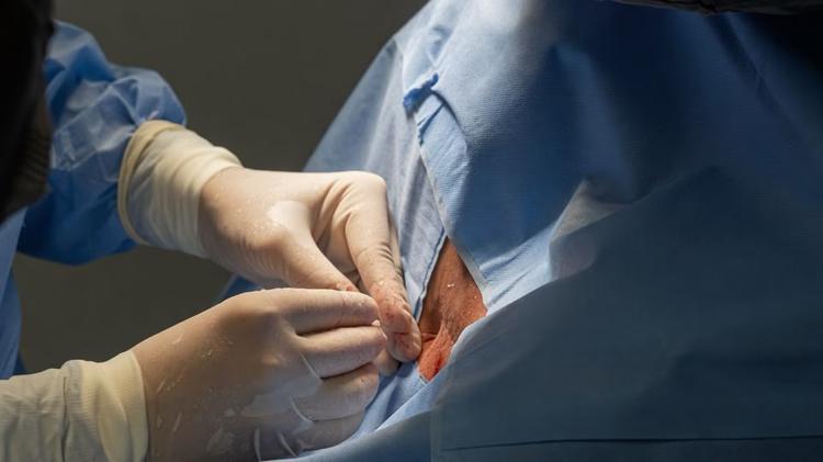 Anvisa soube de 5 mortes quando apenas 19 pacientes tinham recebido polilaminina; laboratório nega relação