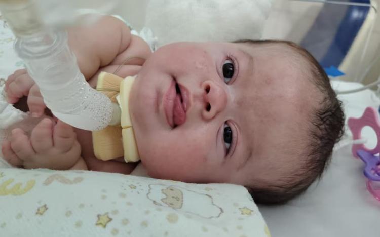 Bebê de 6 meses com doença rara vive em UTI desde que nasceu e aguarda por home care