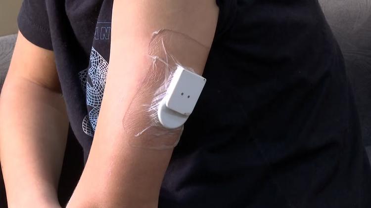 Mesmo com lei sancionada há mais de um ano, famílias ainda esperam por sensores de glicemia para crianças com diabetes no Paraná