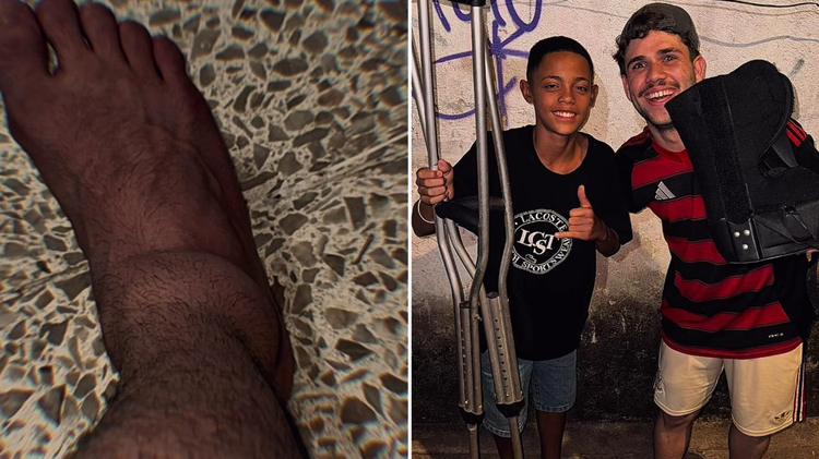 “Fui ao culto de muletas e saí andando”, diz evangelista que recebeu oração de adolescente