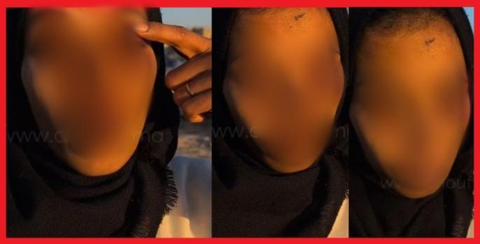 أمن الدار البيضاء يوقف شخصا تورط في اعتداء شنيع على سيدة