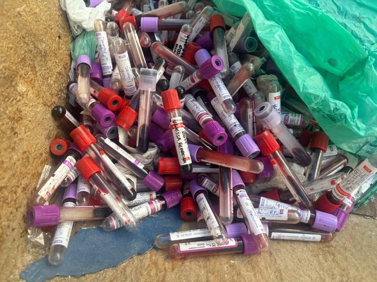 Tubos com sangue de animais são encontrados em caçamba no Centro de Cabo Frio