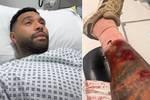 El fichaje frustrado del Madrid "arrojado al abismo" sufre el ataque de un perro: "El mío me salvó la vida"