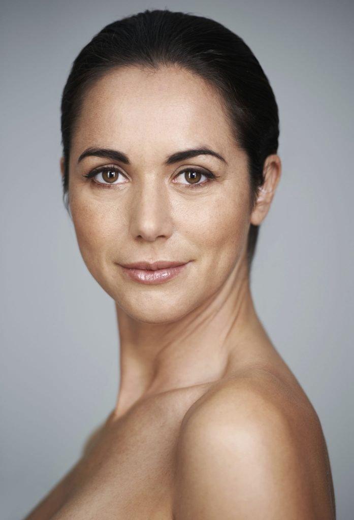 ¿Qué hace el Botox?