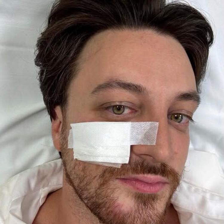 Incidente stradale per Alberto Stefani: "Ho rischiato ma sto bene"