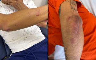 Ataques homofóbicos em SP ficam sem identificação de autores e vítimas relatam frustração
