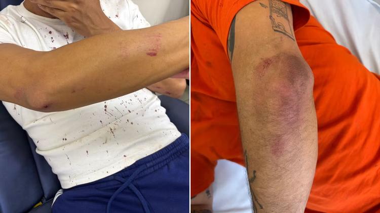 Ataques homofóbicos em SP ficam sem identificação de autores e vítimas relatam frustração
