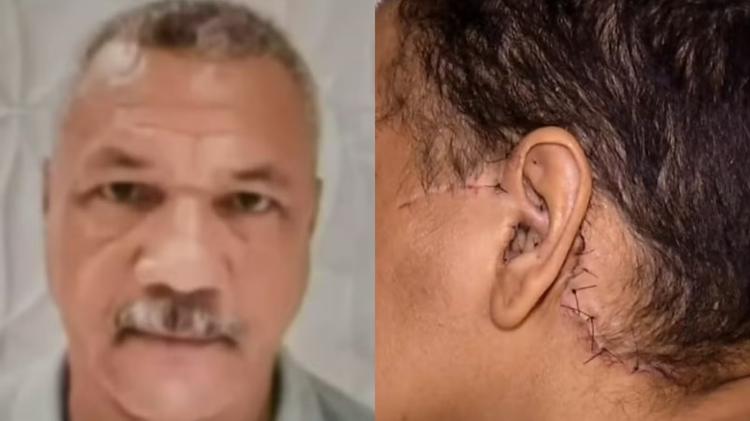 Homem que esfaqueou e decepou orelha da ex por não aceitar fim da relação é julgado em Fortaleza