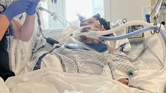 Jovem morre após contrair bactéria "comedora do cérebro" nos EUA