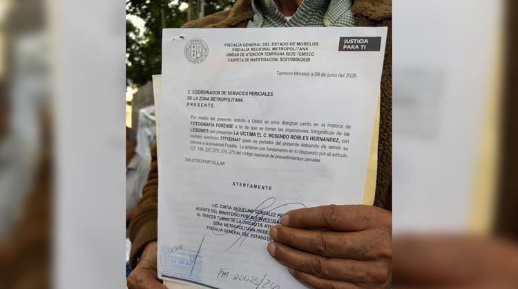 Indignación en Cuernavaca: Adulto mayor denuncia a chofer de Ruta 8 tras brutal caída que le lesionó la columna