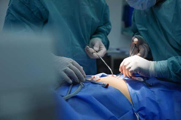 Stress lavoro-correlato in sala operatoria