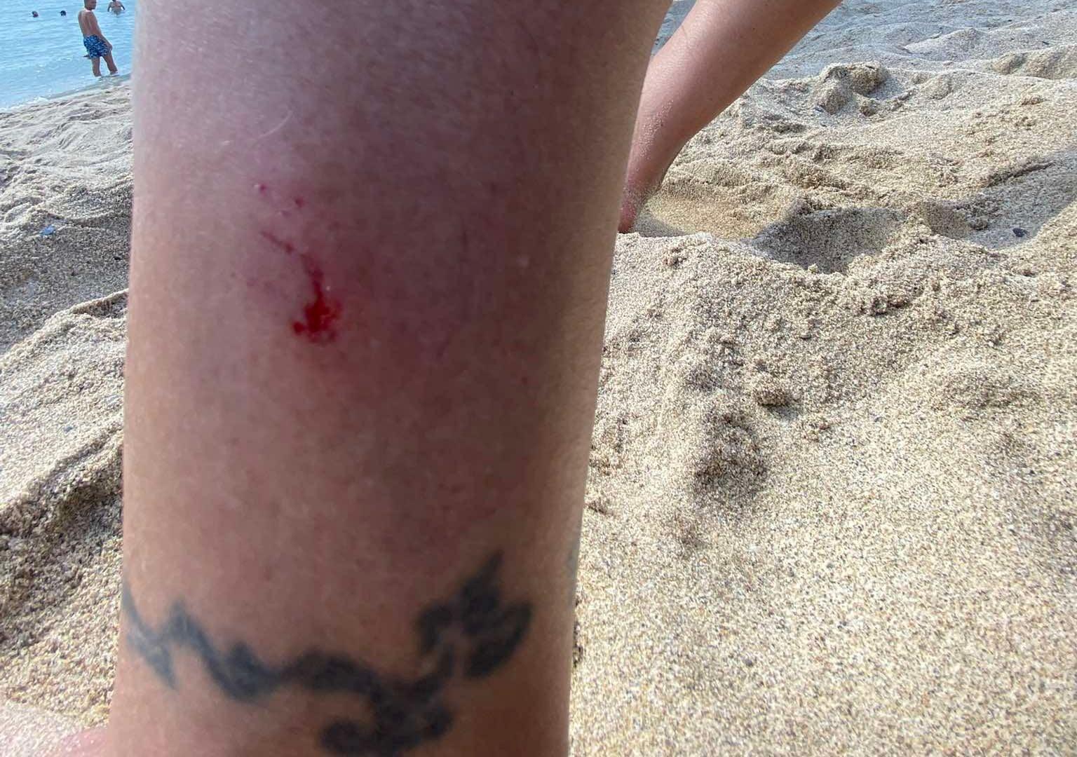 Cilento, nuovi avvistamenti in mare: lievi morsi e l’ipotesi del trigone viola