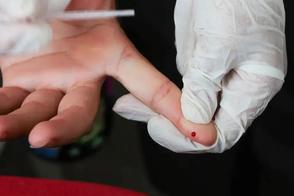 Remissão rara do HIV após transplante de medula indica que a cura é possível, explica médico