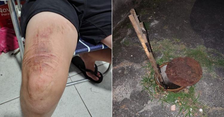“Bueiro armadilha”: morador cai em tampa mal encaixada e se machuca no bairro Nova Esperança