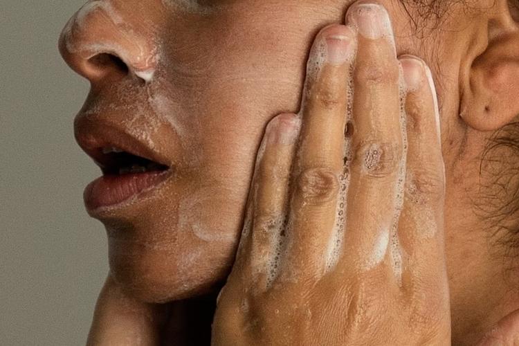 Acne na vida adulta: por que as espinhas aparecem depois dos 30 anos e como tratar?