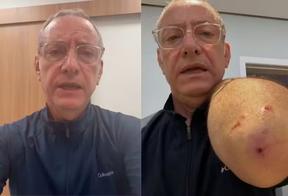 José Roberto Burnier, apresentador do 'SP2' é atacado por pitbull sem guia: 'Está tudo bem agora'