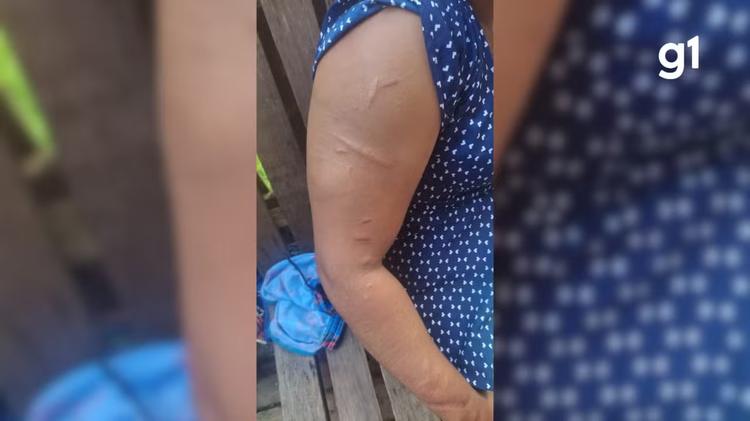 'Me sentindo como um passarinho livre', diz mulher resgatada após ser mantida em cárcere privado por 15 anos no AP