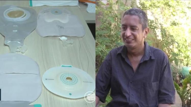 Bolsas de ostomia: pacientes da rede municipal de saúde de Teresina relatam falta de abastecimento e má qualidade dos dispositivos